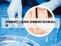 生物制剂打了能停吗 生物制剂打完效果怎么样