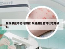 银屑病能不能吃辣椒 银屑病患者可以吃辣椒吗