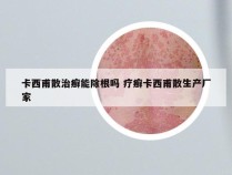 卡西甫散治癣能除根吗 疗癣卡西甫散生产厂家