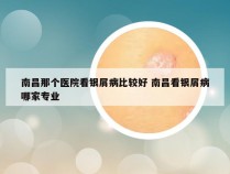 南昌那个医院看银屑病比较好 南昌看银屑病哪家专业