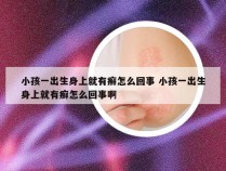 小孩一出生身上就有癣怎么回事 小孩一出生身上就有癣怎么回事啊