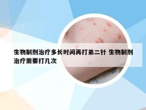 生物制剂治疗多长时间再打弟二针 生物制剂治疗需要打几次