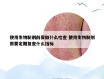 使用生物制剂前要做什么检查 使用生物制剂需要定期复查什么指标