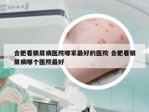 合肥看银屑病医院哪家最好的医院 合肥看银屑病哪个医院最好