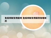 免疫抑制生物制剂 免疫抑制生物制剂有哪些药