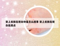 背上皮肤出现白块是怎么回事 背上皮肤出现白色斑点