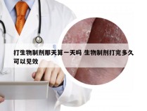 打生物制剂那天算一天吗 生物制剂打完多久可以见效