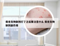 类克生物制剂打了之后要注意什么 类克生物制剂副作用