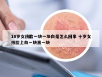 10岁女孩脸一块一块白是怎么回事 十岁女孩脸上白一块黑一块