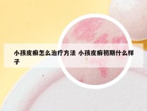 小孩皮癣怎么治疗方法 小孩皮癣初期什么样子