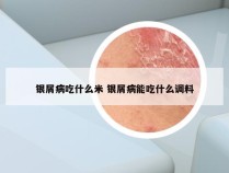 银屑病吃什么米 银屑病能吃什么调料