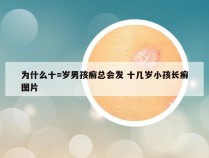 为什么十=岁男孩癣总会发 十几岁小孩长癣图片