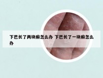 下巴长了两块癣怎么办 下巴长了一块癣怎么办