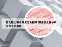 婴儿脸上有小白点怎么回事 婴儿脸上有小白点怎么回事啊