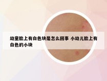 幼童脸上有白色块是怎么回事 小幼儿脸上有白色的小块