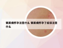 银屑病怀孕注意什么 银屑病怀孕了应该注意什么