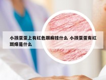 小孩蛋蛋上有红色跟癣挂什么 小孩蛋蛋有红斑痒是什么