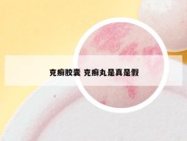 克癣胶囊 克癣丸是真是假