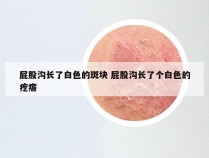 屁股沟长了白色的斑块 屁股沟长了个白色的疙瘩