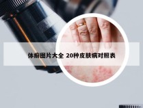 体癣图片大全 20种皮肤病对照表