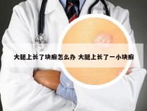 大腿上长了块癣怎么办 大腿上长了一小块癣