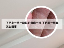 下巴上一块一块红的像癣一样 下巴起一块红怎么回事