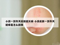 小孩一到冬天皮肤就长癣 小孩皮肤一到冬天就痒是怎么回事