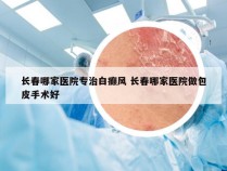 长春哪家医院专治白癫风 长春哪家医院做包皮手术好