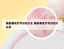 银屑病光疗可以吃什么 银屑病光疗可以吃什么药