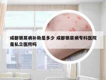 成都银屑病补助是多少 成都银屑病专科医院是私立医院吗