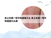 身上长癣一样不知道是什么 身上长癣一样不知道是什么病