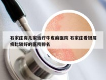 石家庄有几家治疗牛皮癣医院 石家庄看银屑病比较好的医院排名