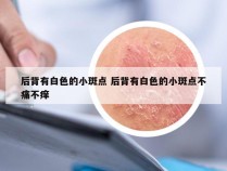 后背有白色的小斑点 后背有白色的小斑点不痛不痒