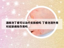 酒精泡丁香可以治疗皮肤癣吗 丁香泡洒外用对皮肤病有作用吗