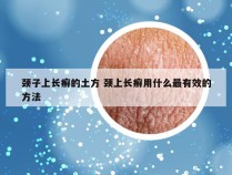 颈子上长癣的土方 颈上长癣用什么最有效的方法