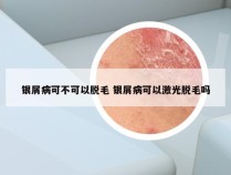 银屑病可不可以脱毛 银屑病可以激光脱毛吗