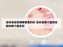 吉林省皮肤病哪里看的好 吉林省哪个医院皮肤科哪个医生好