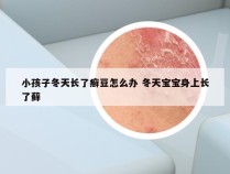 小孩子冬天长了癣豆怎么办 冬天宝宝身上长了藓