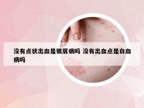 没有点状出血是银屑病吗 没有出血点是白血病吗