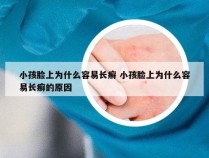 小孩脸上为什么容易长癣 小孩脸上为什么容易长癣的原因