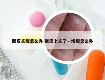 眼皮长癣怎么办 眼皮上长了一块癣怎么办