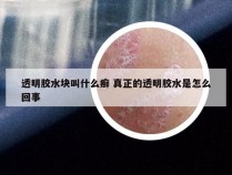 透明胶水块叫什么癣 真正的透明胶水是怎么回事