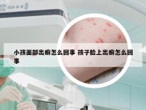 小孩面部出癣怎么回事 孩子脸上出癣怎么回事