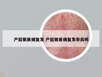 产后银屑病复发 产后银屑病复发率高吗