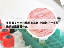 小腿长了一小片像癣的东西 小腿长了一小片像癣的东西是什么