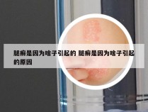 腿癣是因为啥子引起的 腿癣是因为啥子引起的原因