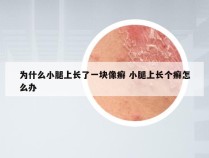 为什么小腿上长了一块像癣 小腿上长个癣怎么办