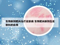 生物制剂靶向治疗皮肤病 生物靶向制剂在皮肤科的应用