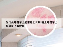 为什么睡觉早上起来身上长癣 晚上睡觉早上起来身上有挖痕