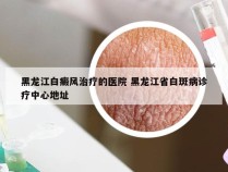 黑龙江白癜风治疗的医院 黑龙江省白斑病诊疗中心地址